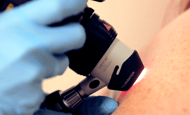 Diagnostic method for plantar warts