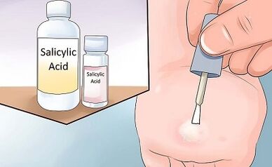 How to get rid of the way people of papillomas