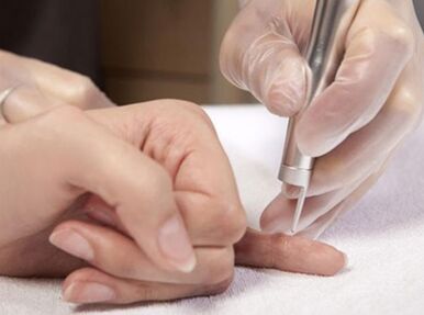 Perform laser therapy